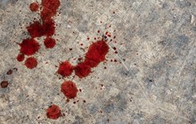Blood Pattern Analysis Awareness for Clothing (BPA2b)