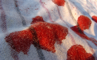 Blood Pattern Analysis