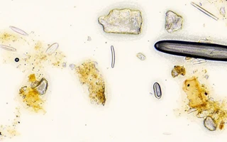 Diatom Analysis