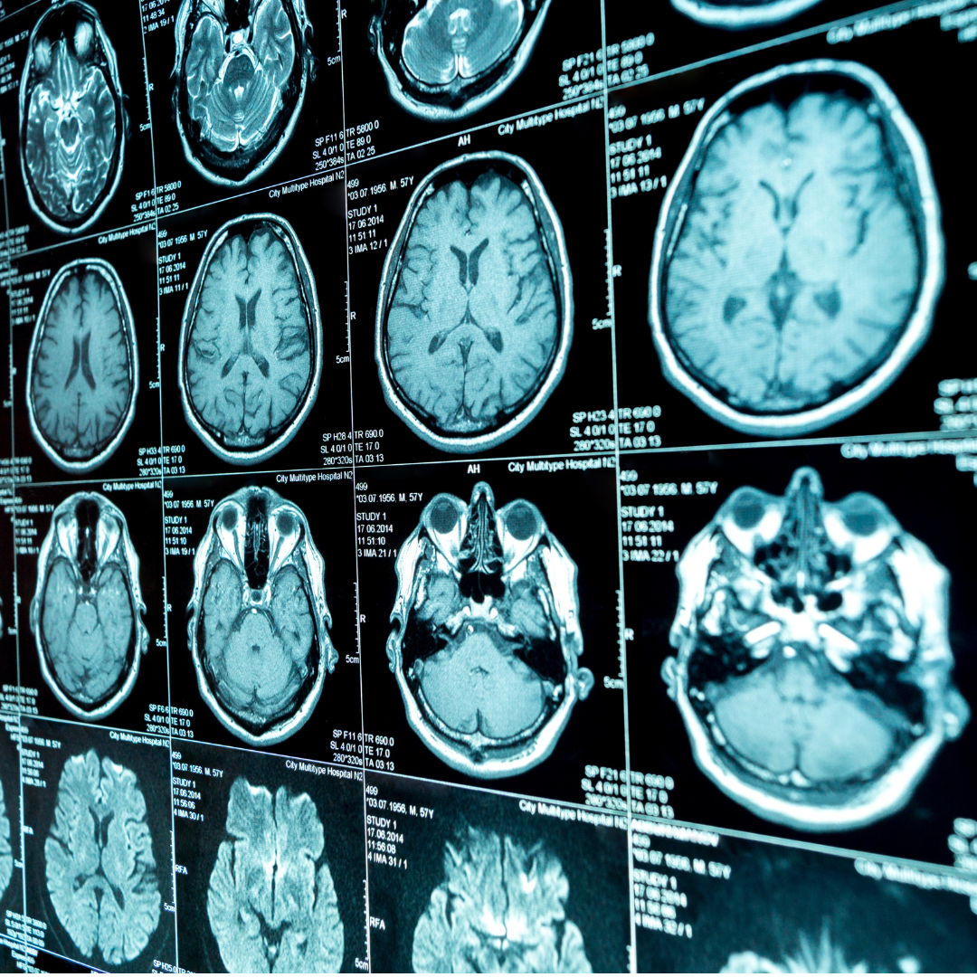Neuropathology Neuropathology