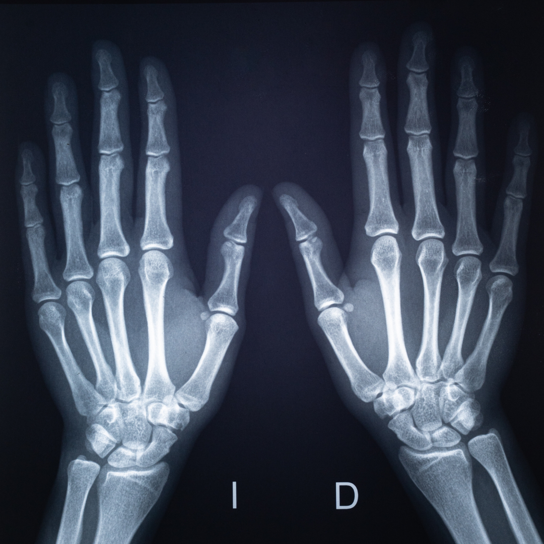 Osteoarticular Pathology Osteoarticular Pathology