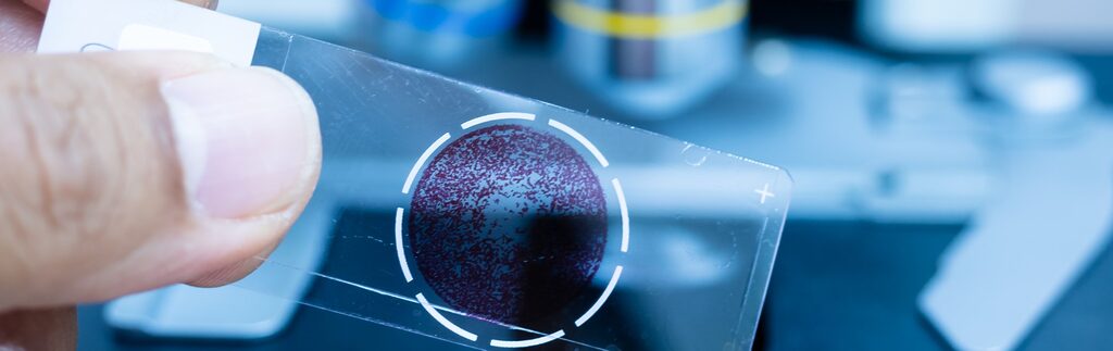 Interview With Forensic Pathologist Stuart Hamilton