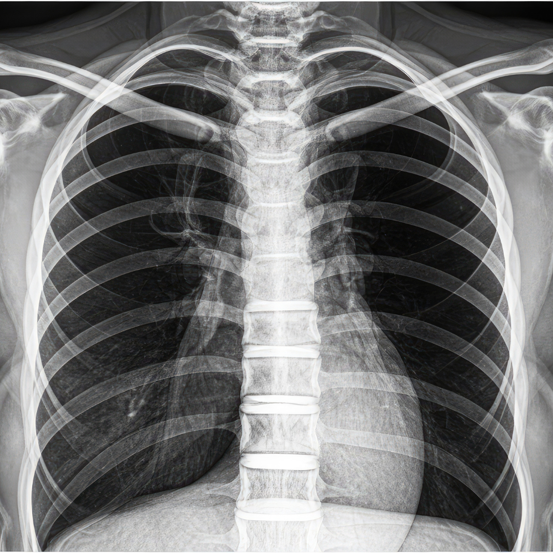Cardiopathology Cardiopathology