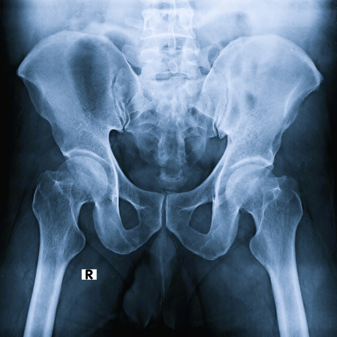 Sexual Injuries And Urology Sexual Injuries And Urology