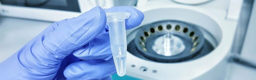 How To Evaluate Dna Evidence: Source Level Reporting (Part 1)