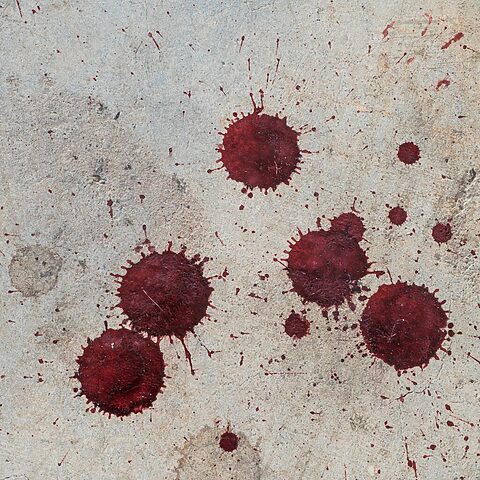 Void Pattern Forensics Forensic Biology | Forensic Access