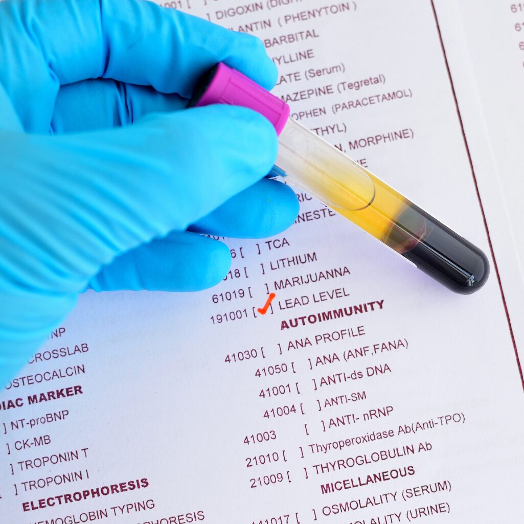 Forensic Toxicology Experts Forensic Toxicology Experts