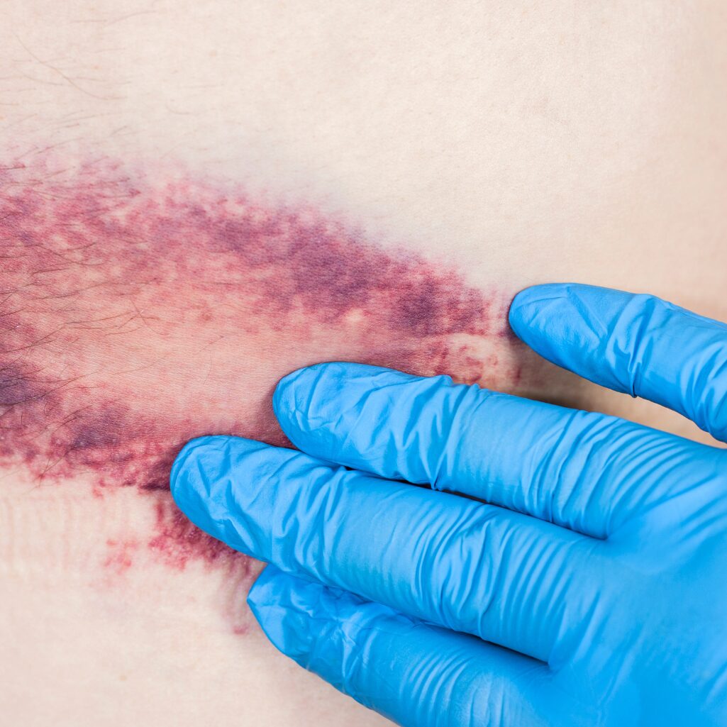 Pathology Injury Causation Pathology Injury Causation